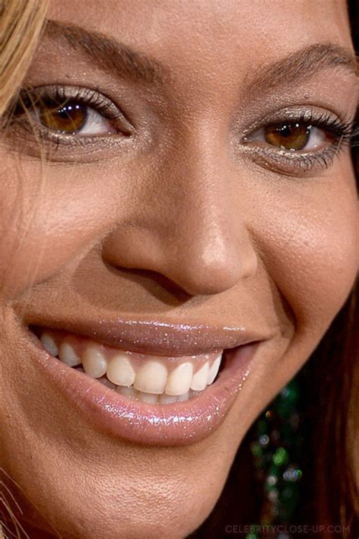 Beyonce with and without teeth grillz.