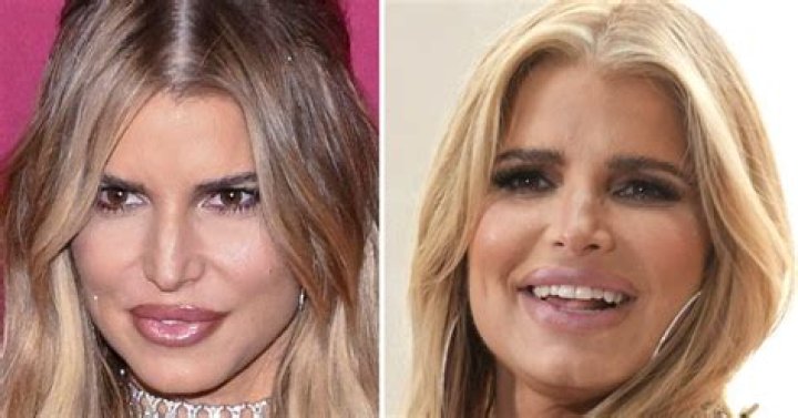 Chloe Ting Plastic Surgery: Unmasking the Truth!