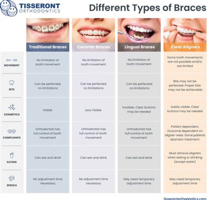 Considering Braces as an Adult? Here's What You Need to Know About Your Options