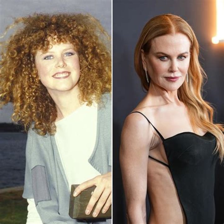 Did Nicole Kidman Have Plastic Surgery? The Truth Unveiled