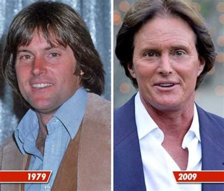 Eddie Vedder Plastic Surgery: Did The Appearance of Singer Change By Age?