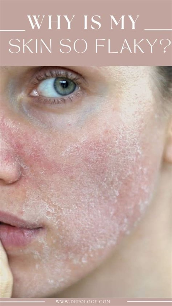 How to Remove Flaky Skin From Your Face, According to Derms