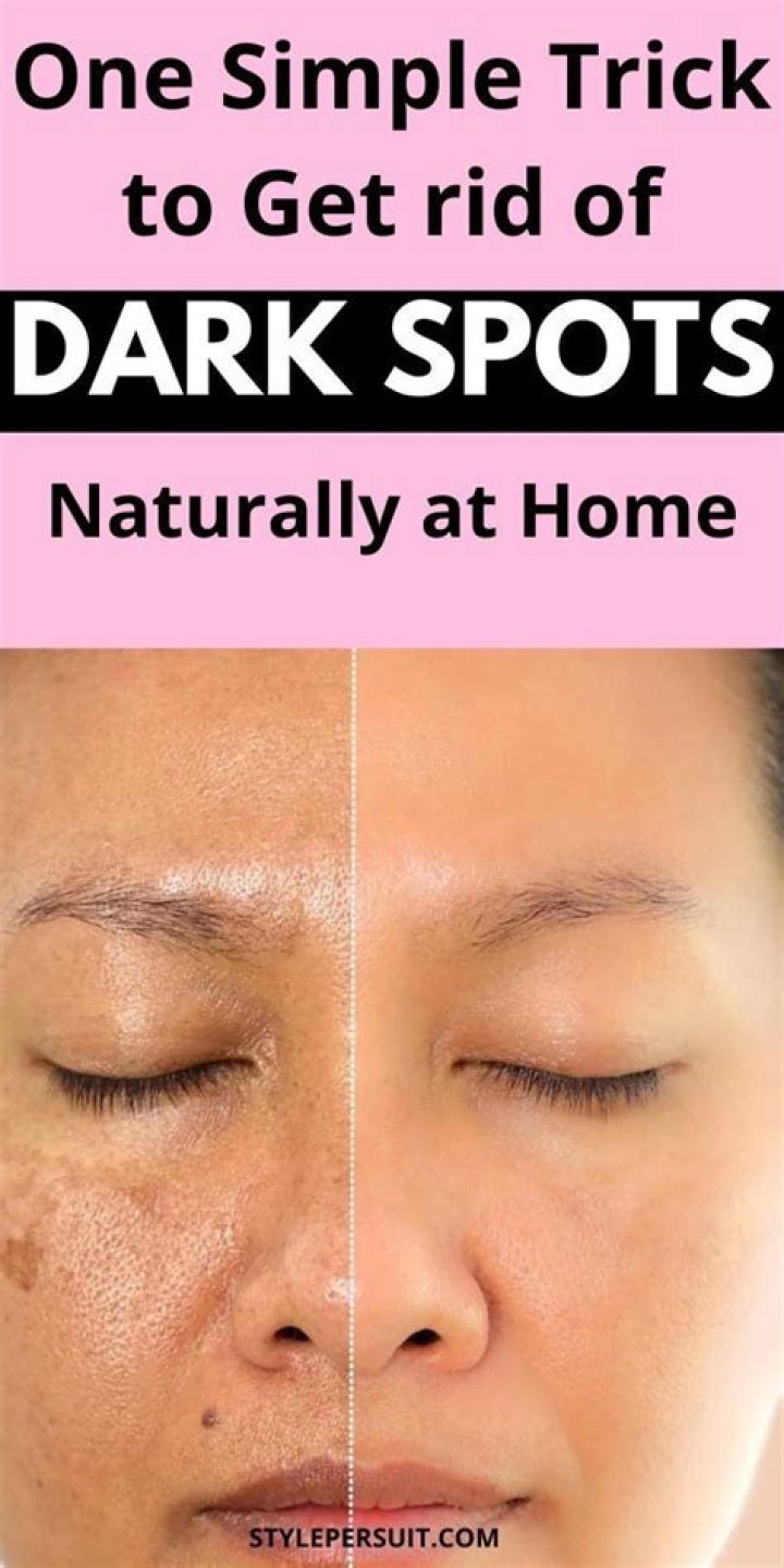 How To Remove Spots From Face In Naturally
