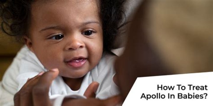 How To Treat Apollo At Home