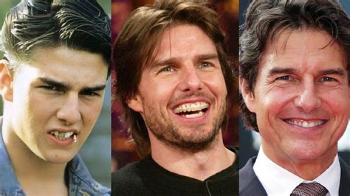 Man Discovers Secret Behind Tom Cruise's Smile