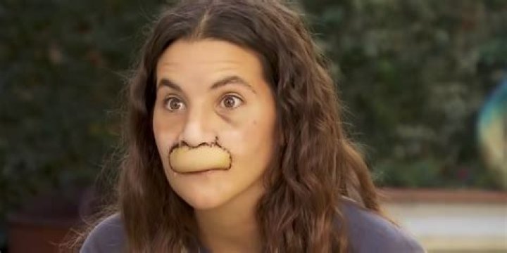 Model whose lip was bitten off by dog shows off transformation after six surgeries