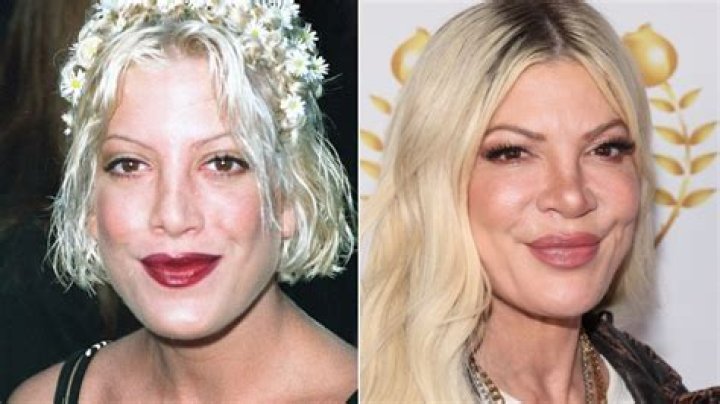 Tori Spelling Plastic Surgery: 'BH90210' Actress Talks Rumors